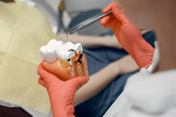 Single Sitting Root Canal Treatment