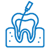 ROOT CANAL TREATMENT